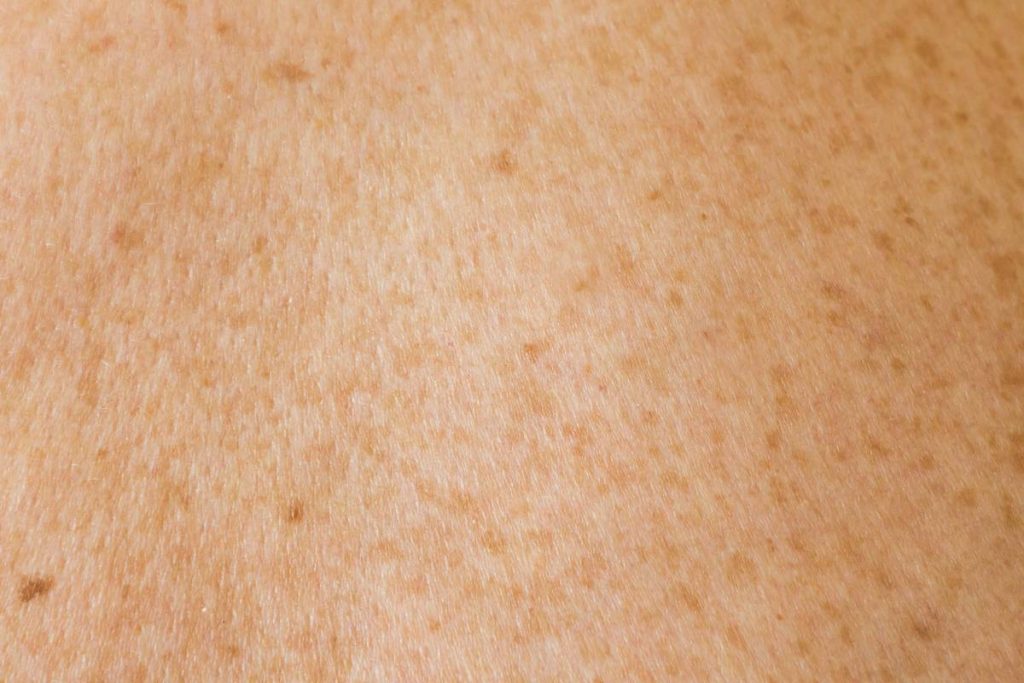 Is Body Scrub Good for Skin: 7 Proven Tips to Avoid Painful Mistakes