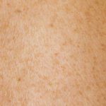 Is Body Scrub Good for Skin: 7 Proven Tips to Avoid Painful Mistakes