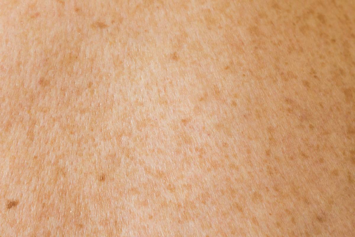 Is Body Scrub Good for Skin: 7 Proven Tips to Avoid Painful Mistakes